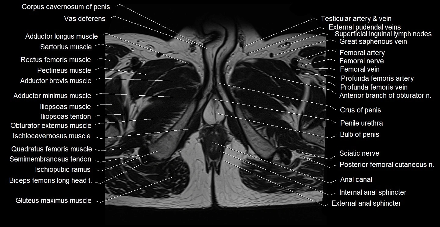 Male pelvis axial cross sectional anatomy image 43.webp